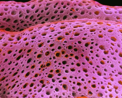 Endometrium ovulation Endometrium ovulation